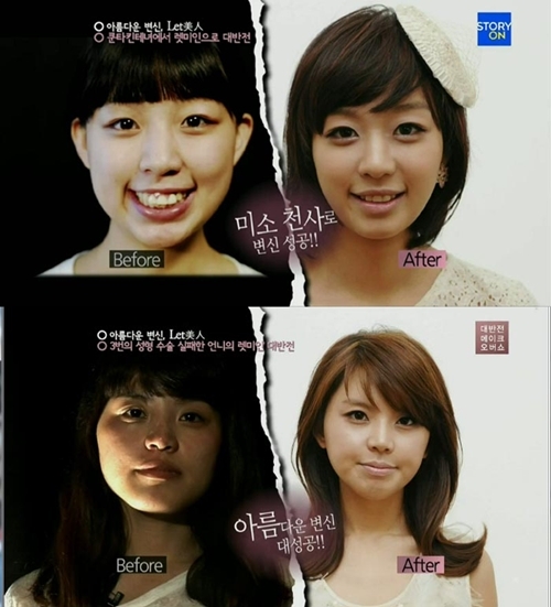 렛미인 이미지