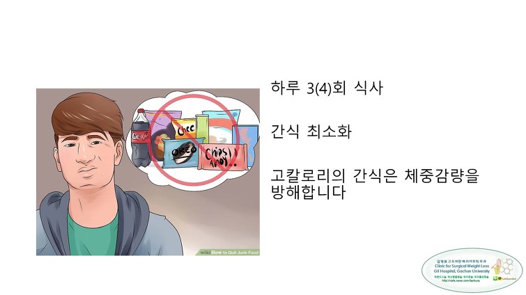 고도비만수술의 대세 위소매절제술 후 일반식하기